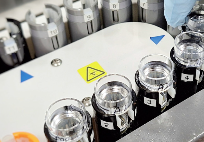 Jo toinen verikoe käyttöön Alzheimerin taudin diagnostiikkaan Itä-Suomen yliopiston Biomarkkerilaboratoriossa