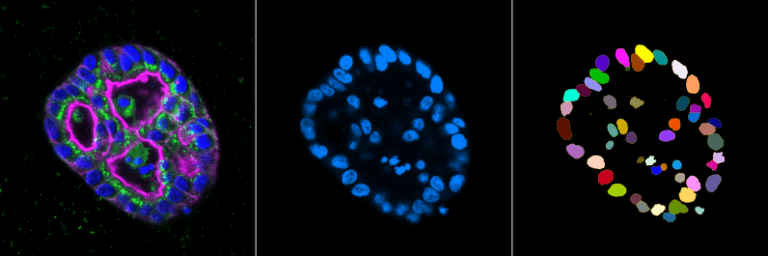 Image Analysis - Cell and Tissue Imaging Unit