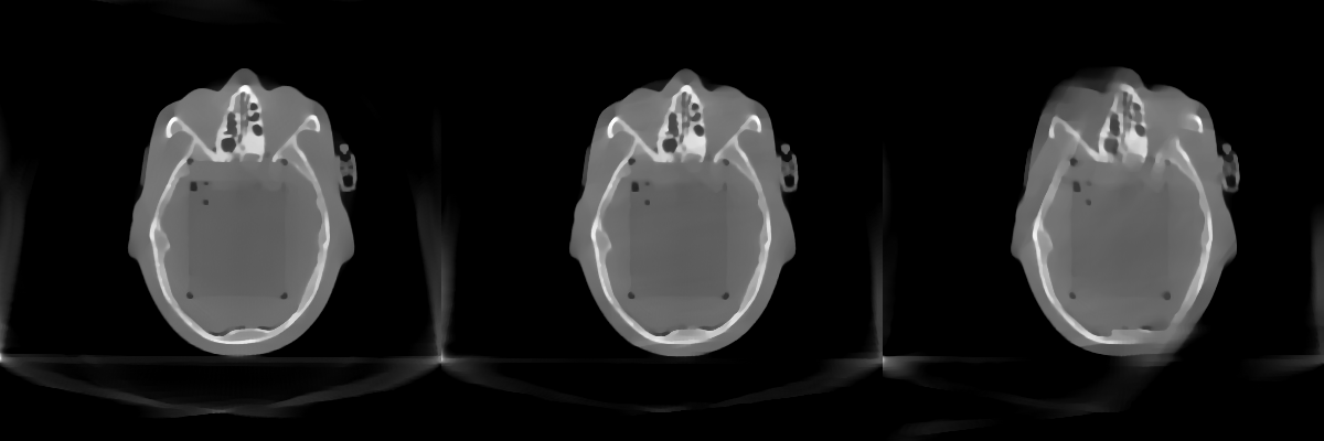 TV regularized reconstructions of a head phantom from limited angle CT data using an integrated CT scanner on a radiotherapy accelerator. Scanning angle (left to right): 200, 160 and 120 degrees.