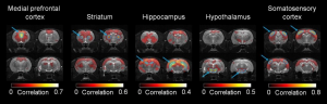 Resting-state fMRI dataset