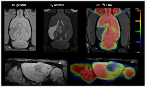 Combined PET-MRI dataset in TBI