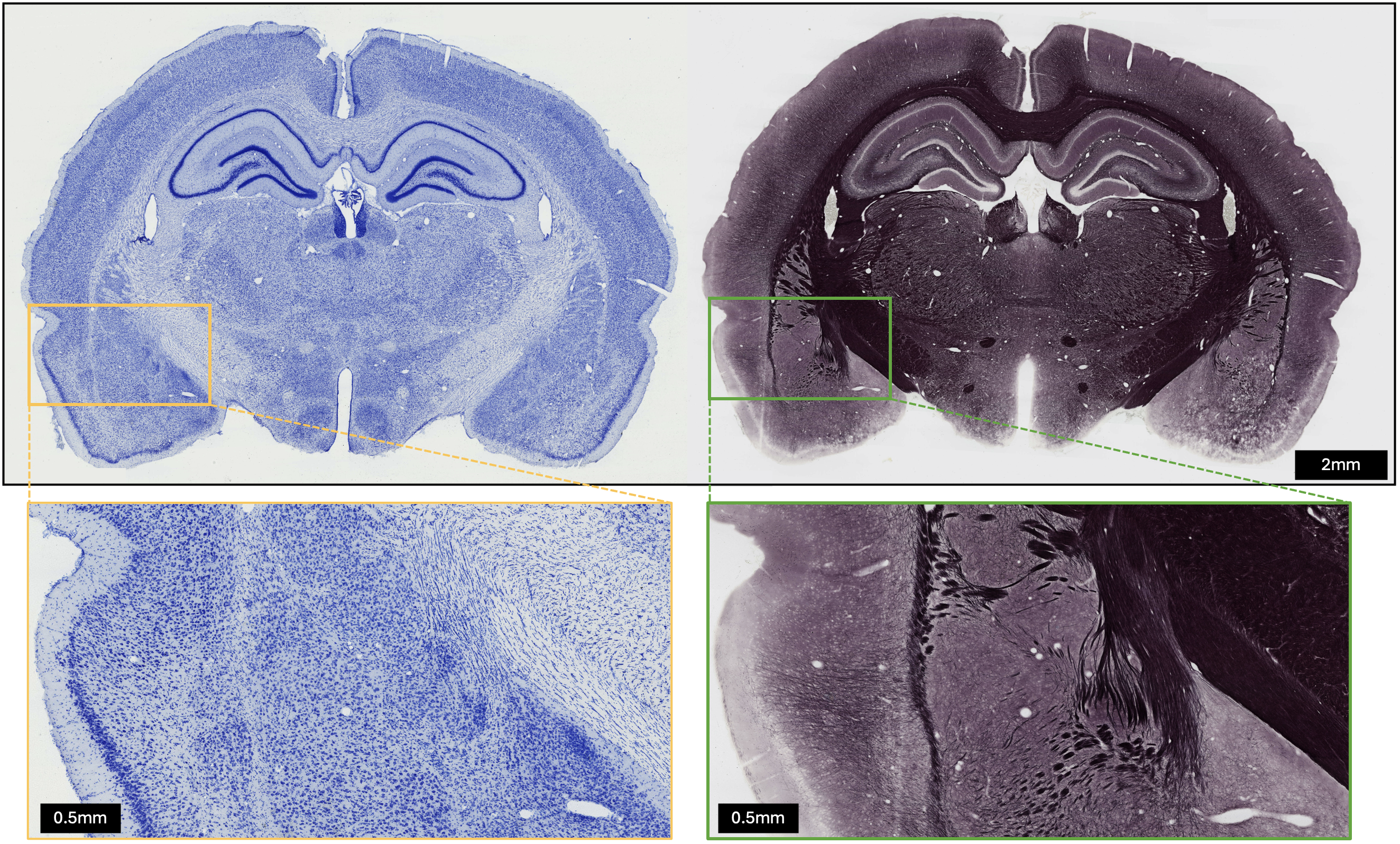 Images of brains