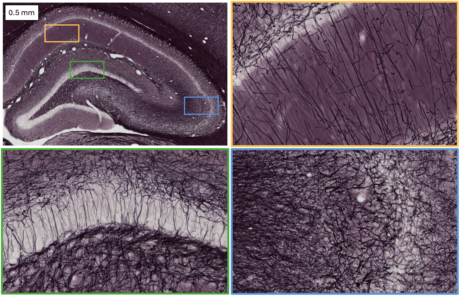 Images of brains