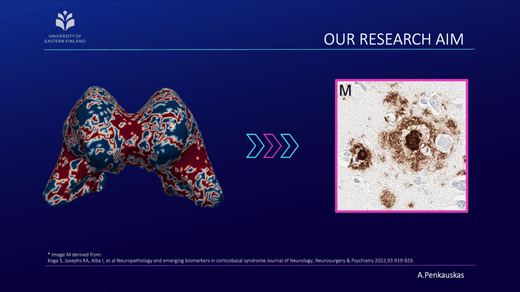 Our approach in predicting amyloid pathology