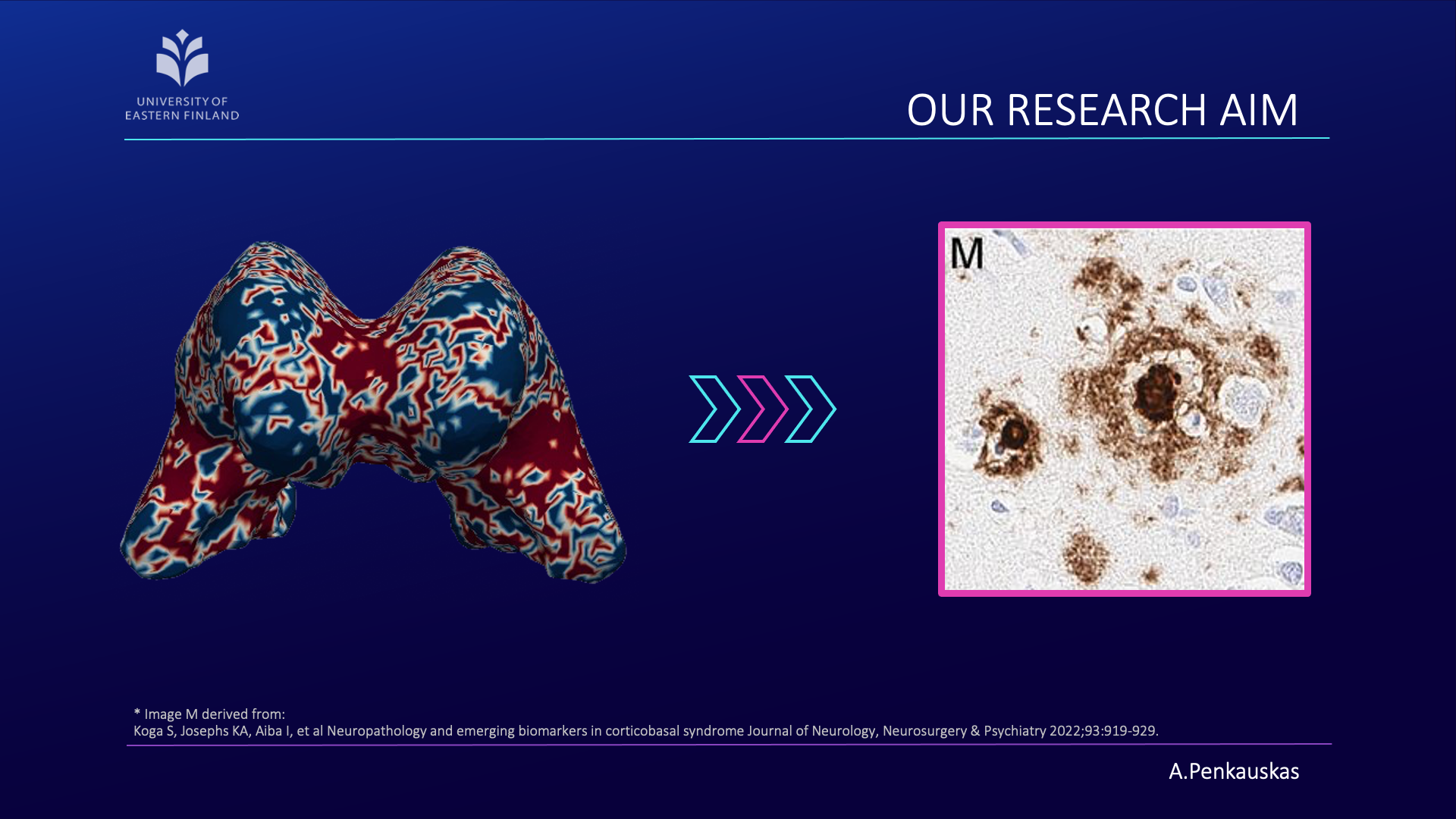 Our approach in predicting amyloid pathology