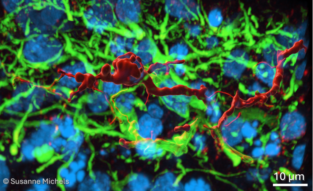 Microscope image 3D reconstruction of somatostatin positive inhibitory neuron in human brain organoid assembloid